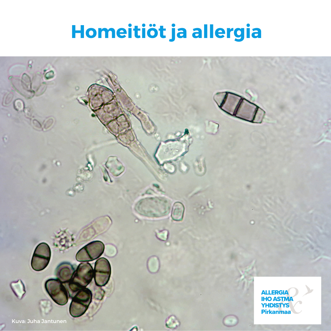 Kuvituskuvana homeitiöitä.